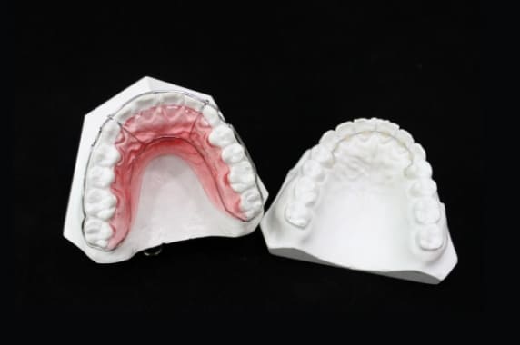 矯正後の保定装置(リテーナー)を製作する必要があります。