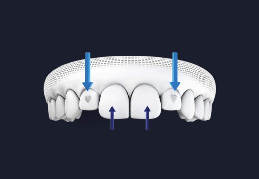 SmartForce Features