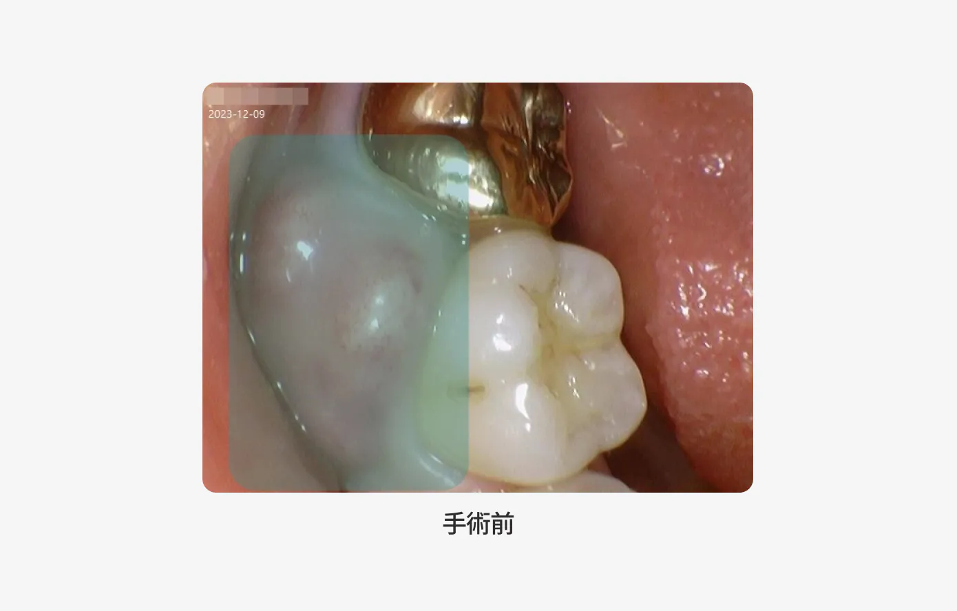手術前