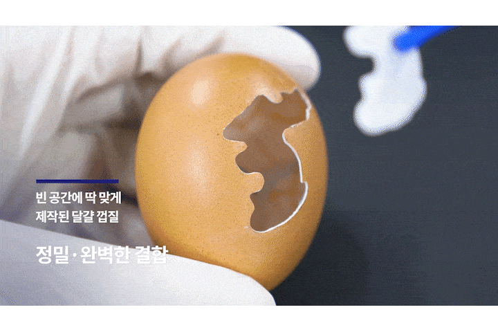 ザ・スクエア歯科 ミニッシュの精密度
