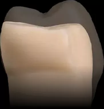 Overlay B