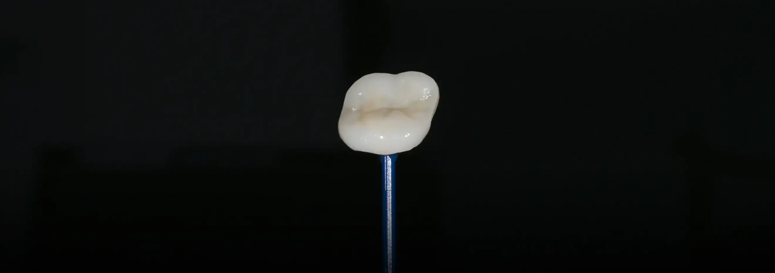 最近の歯科医療のパラダイムは、歯をできるだけ削らず、長く保存できるコンセプト(minimally invasive)