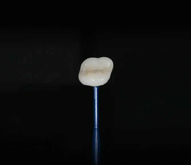 最近の歯科医療のパラダイムは、歯をできるだけ削らず、長く保存できるコンセプト(minimally invasive)