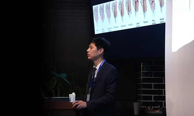 自然で長持ちする前歯インプラントのためには、歯茎までしっかり考慮することが重要です。
