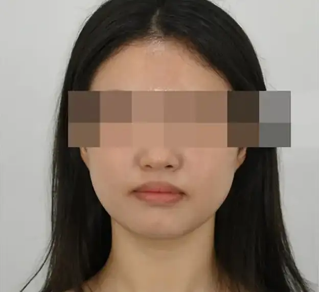 本当の歯の矯正は顔を一緒に見なければなりません。