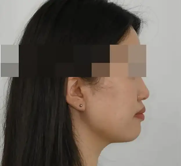 本当の歯の矯正は顔を一緒に見なければなりません。