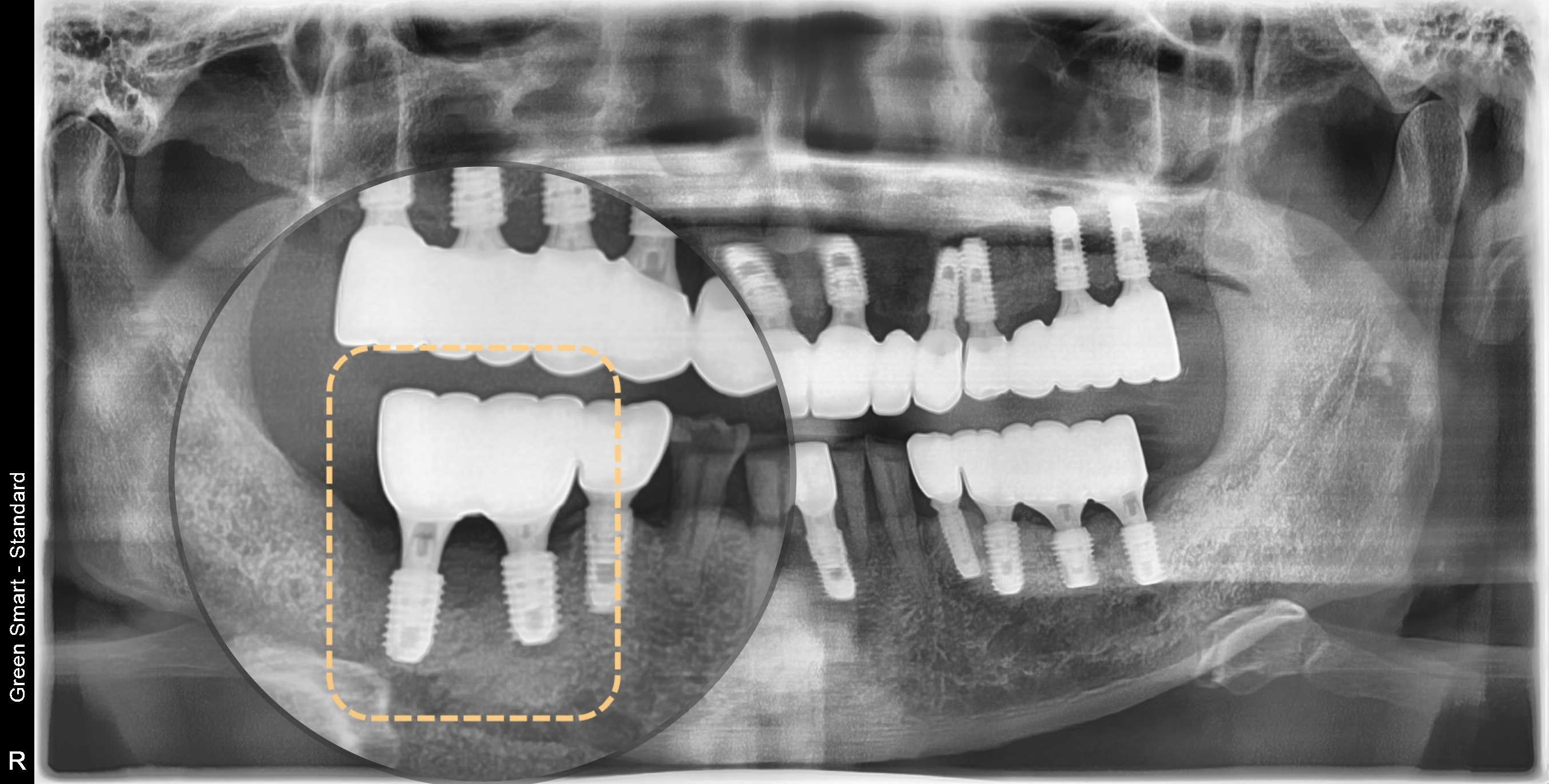 <br />
<b>Warning</b>:  Undefined variable $ba_title in <b>/home/thesquaredc.co.kr/jp/clinical-case/clinicalcase.php</b> on line <b>605</b><br />
