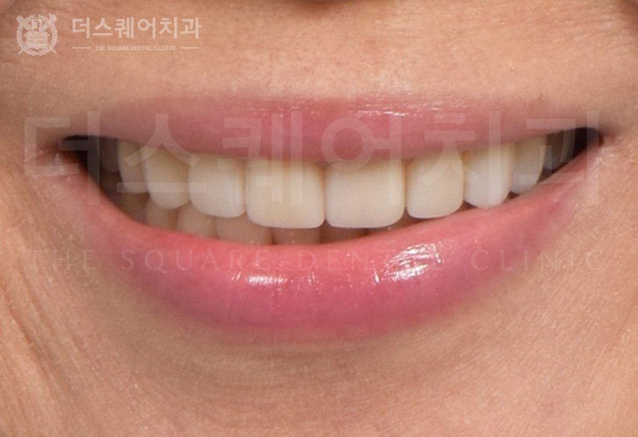 <br />
<b>Warning</b>:  Undefined variable $ba_title in <b>/home/thesquaredc.co.kr/jp/clinical-case/clinicalcase.php</b> on line <b>605</b><br />
