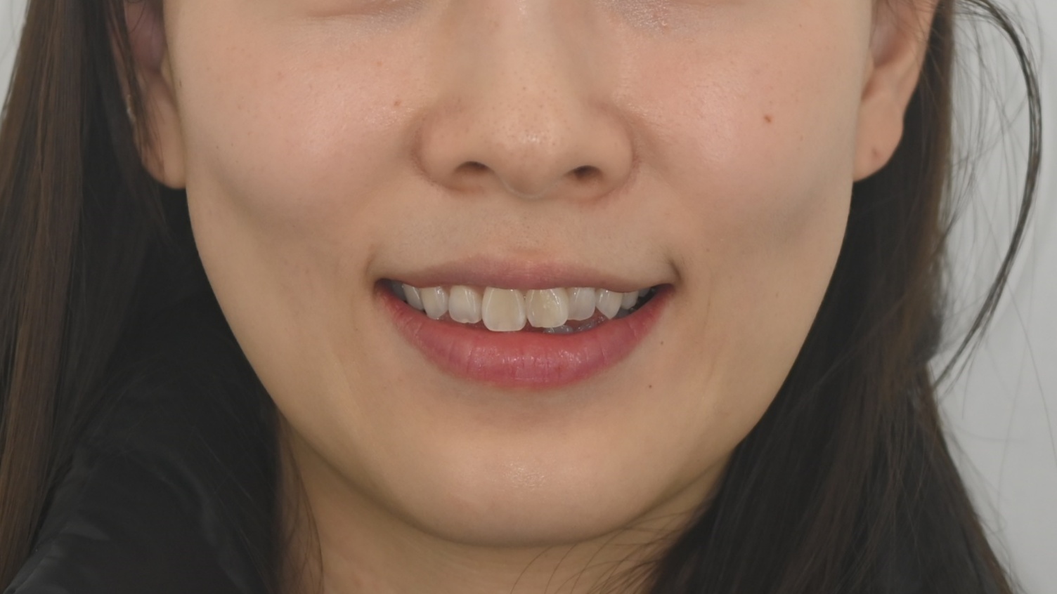 위아래 미니쉬 하모니