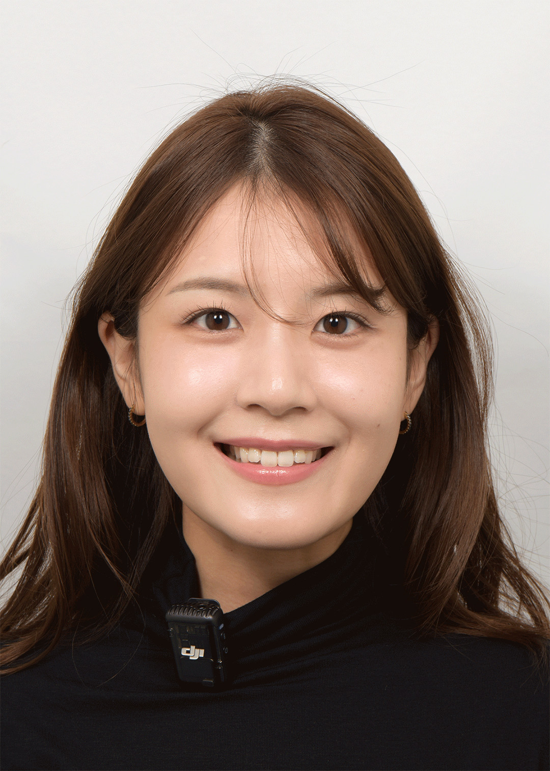 치아 배열과 색상을 비니어큐브로 하루만에 해결한 케이스